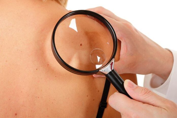 HPV -vel rendelkező betegek vizsgálata